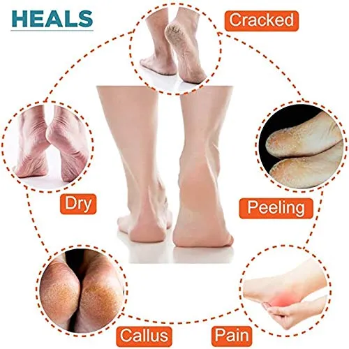 Gel Heel Socks r5.webp